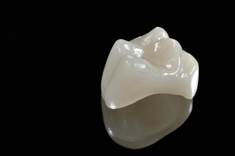 Porcelain Crowns Fort Smith, AR